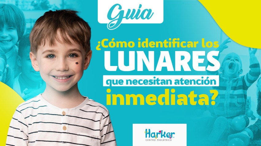 Foto principal de GUÍA ¿CÓMO IDENTIFICAR LOS LUNARES QUE NECESITAN ATENCIÓN INMEDIATA? 