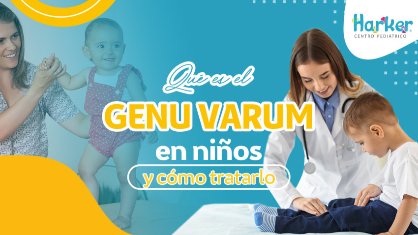 Foto principal de QUÉ ES EL GENU VARUM EN NIÑOS Y CÓMO TRATARLO